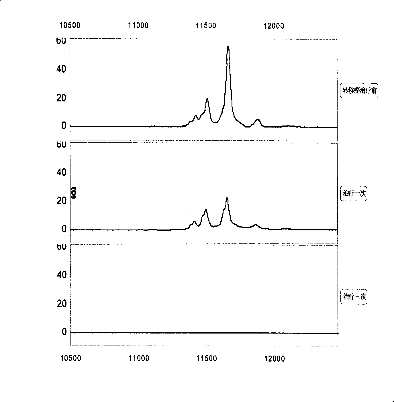 Reagent kit and method for detecting tumor recurrence and transfer and evaluating curative effect