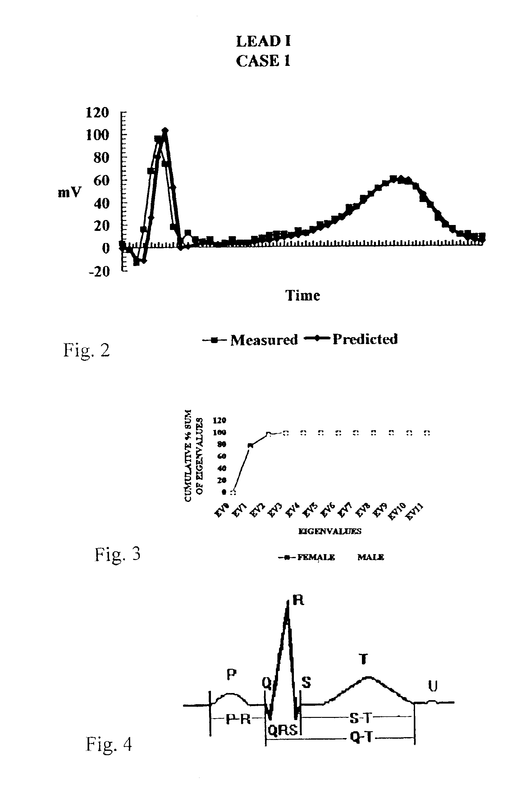 System and method for predicting the onset of cardiac pathology using fractal analysis