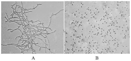 Microbial agent for repairing garlic continuous cropping soil and preparation method and application thereof