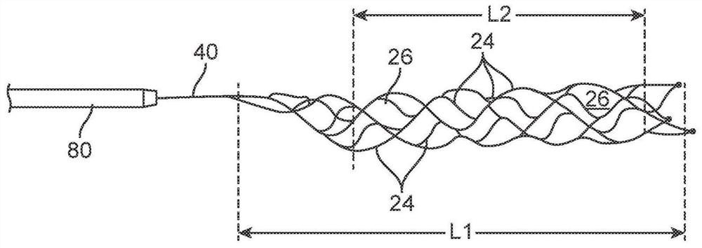 Thrombectomy device