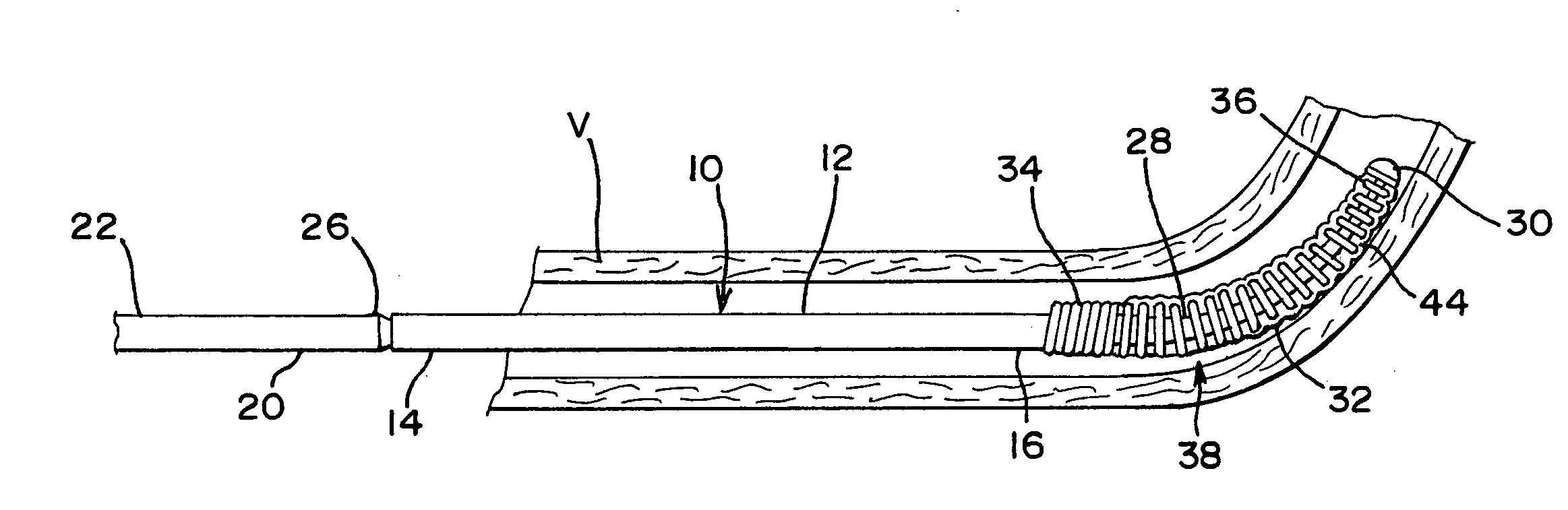 Variable stiffness guidewire