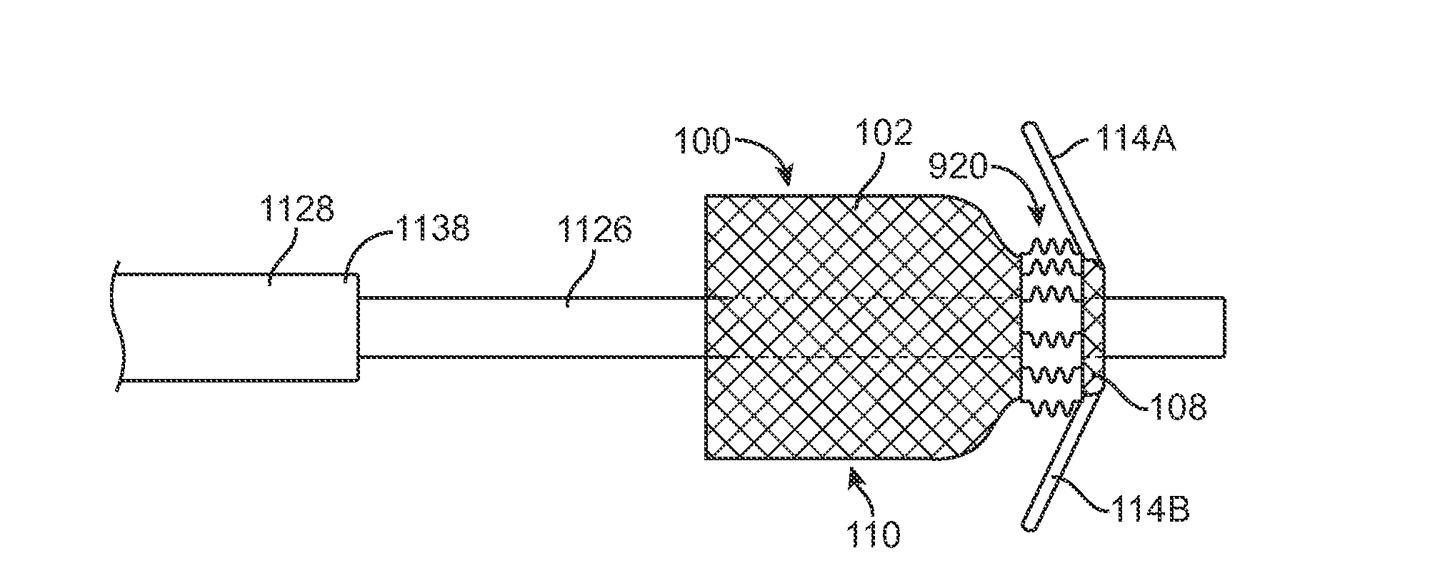 Transcatheter Valve Prosthesis and a Concurrently Delivered Sealing Component