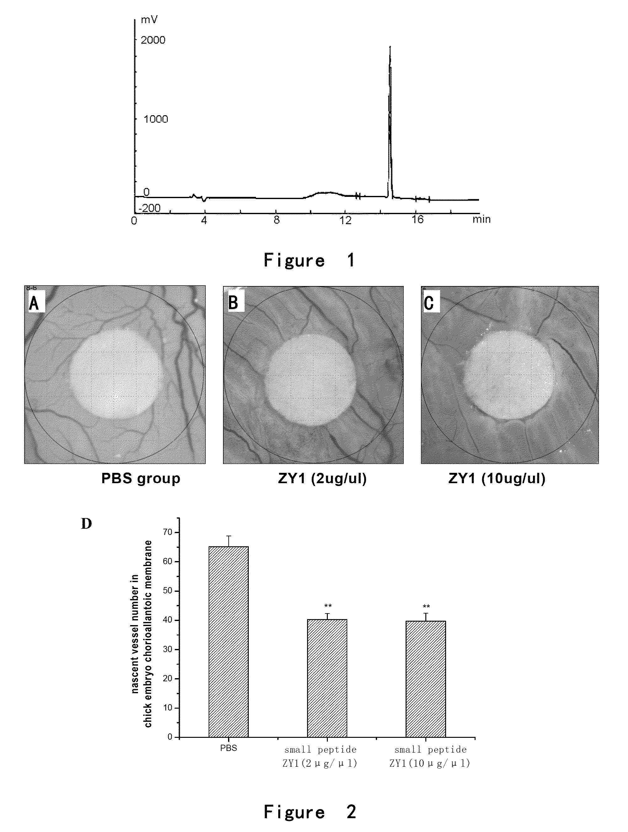 Angiogenesis-inhibiting peptide and application thereof