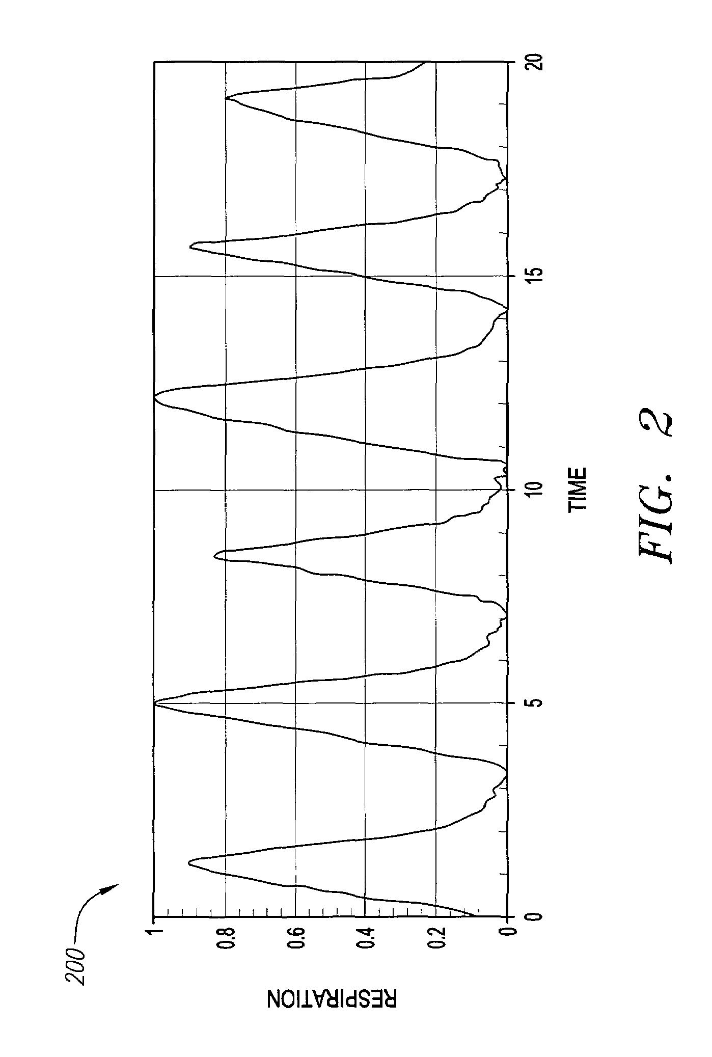 Method and system for monitoring breathing activity of a subject