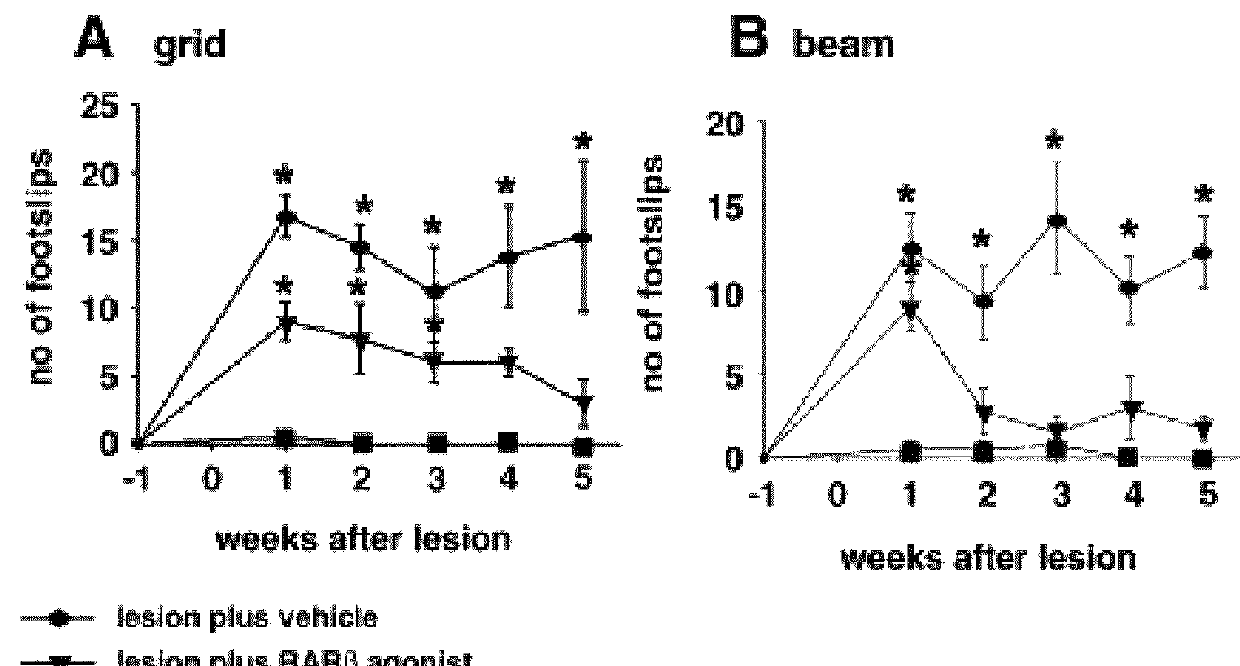 Bicycloheteroaryl-heteroaryl-benzoic acid compounds as retinoic acid receptor beta (RARβ) agonists