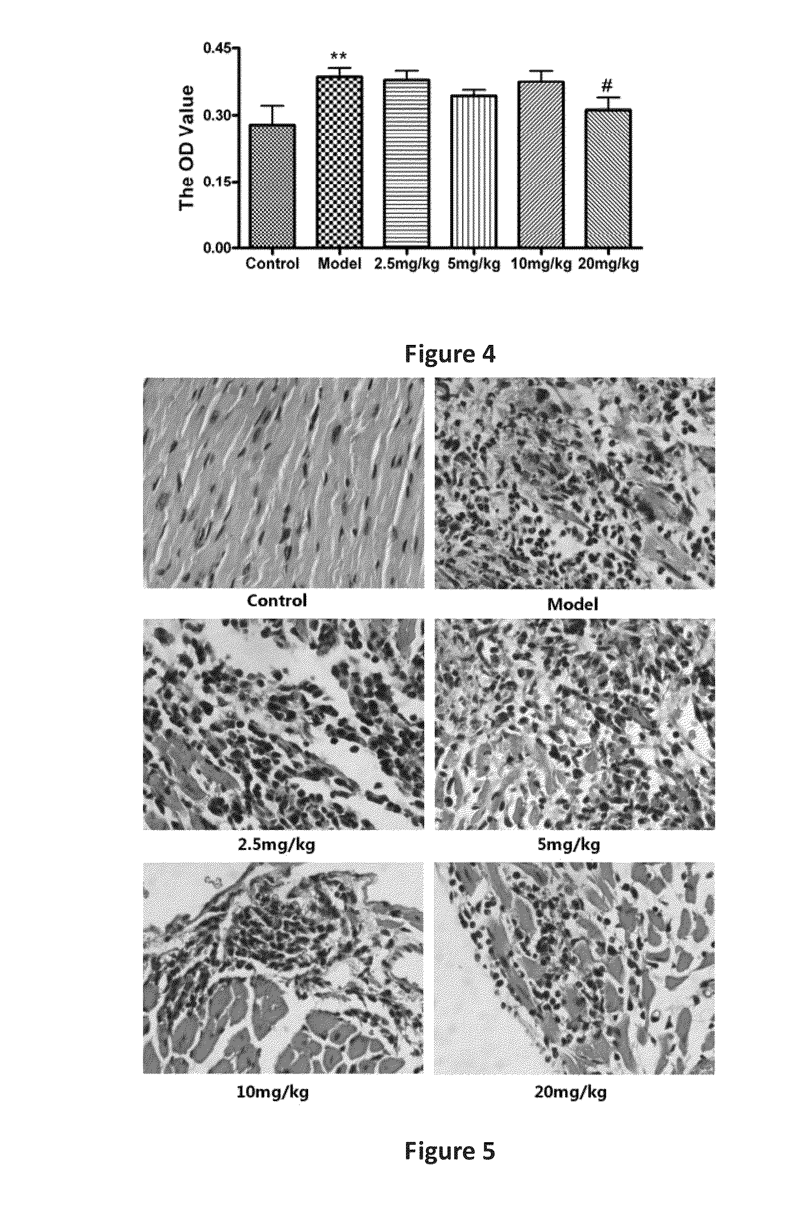 Line leaf inula flower lactone a and methods for preparing and using the same for treating myocarditis