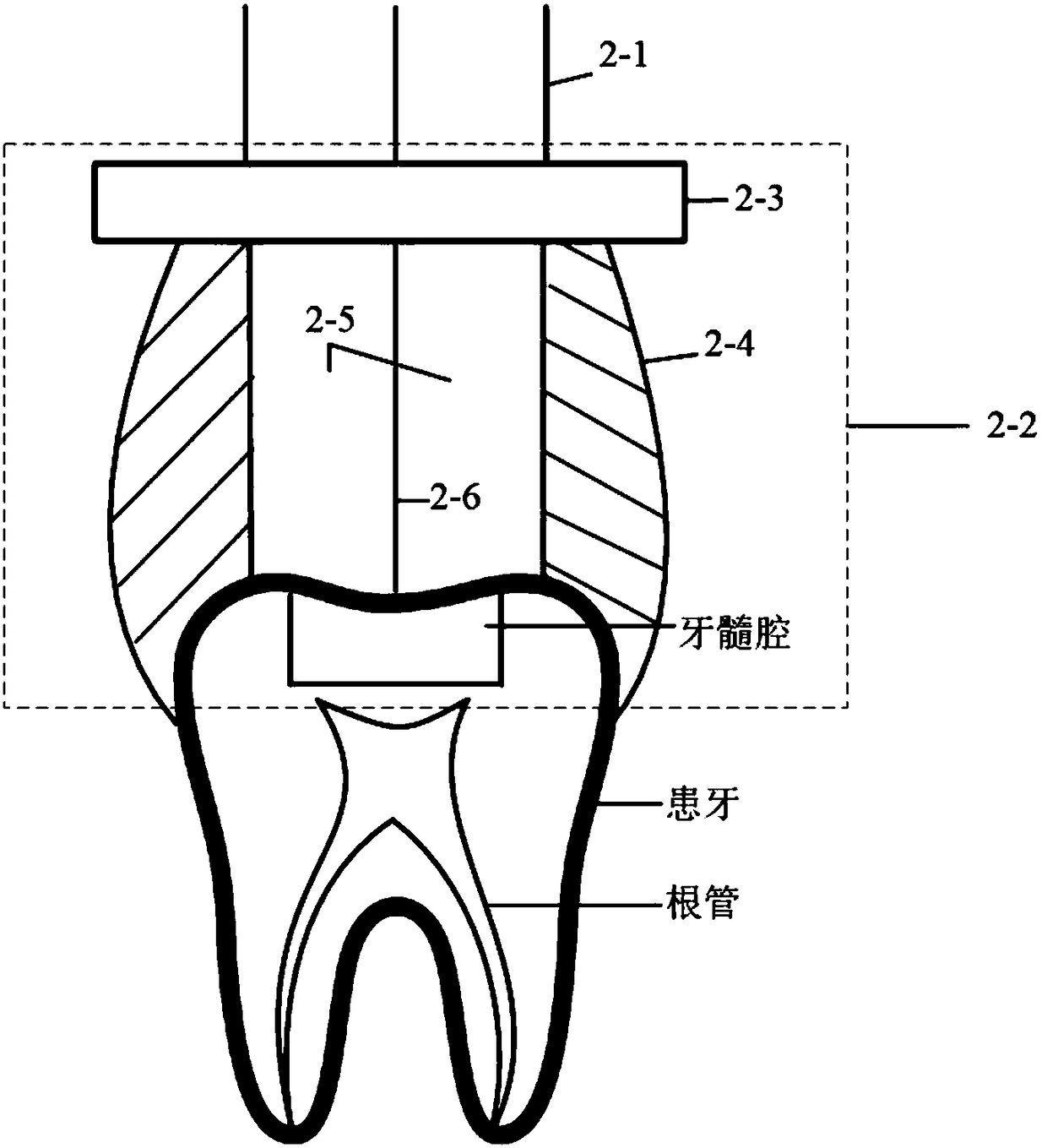 Root canal surgery robot