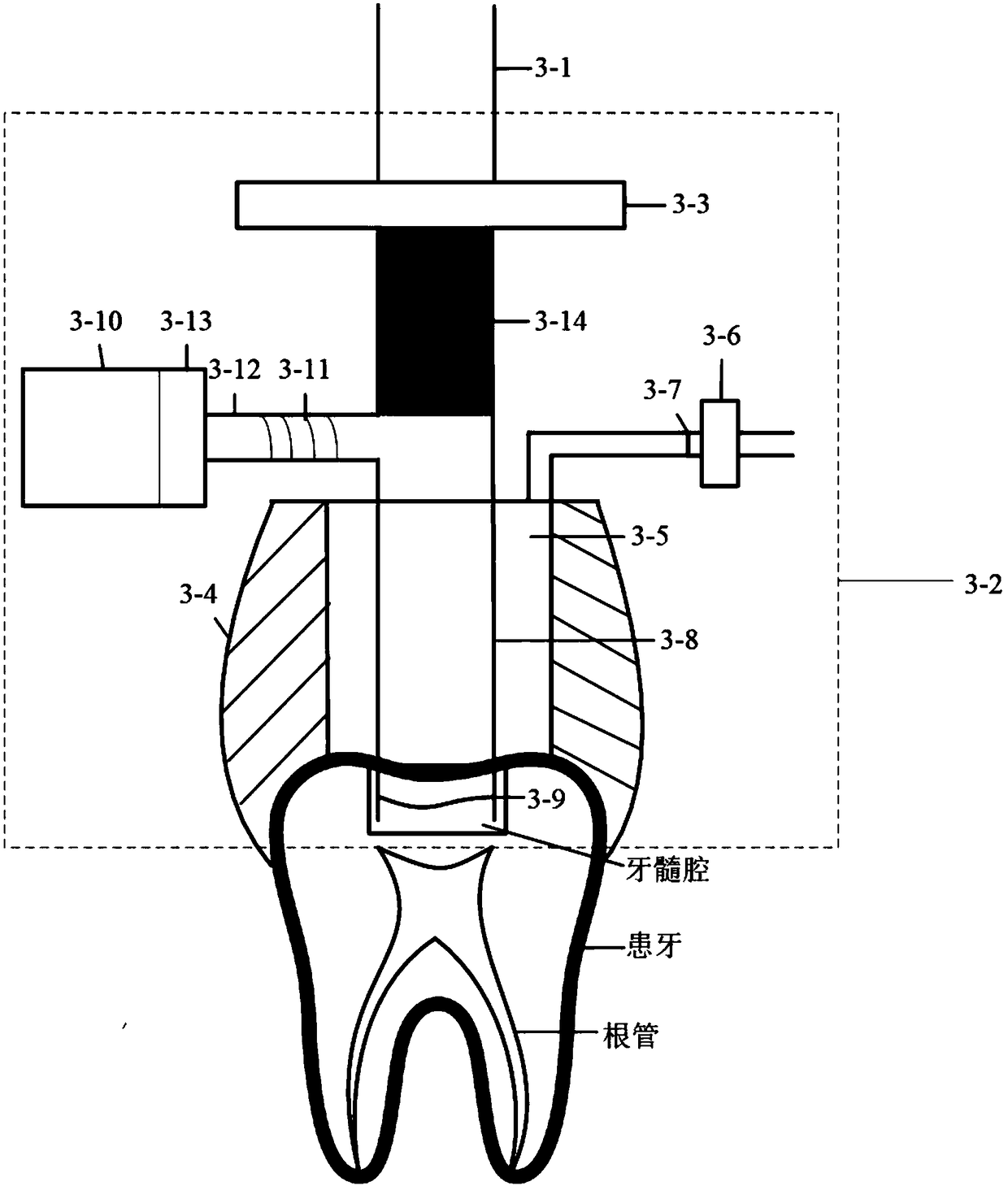 Root canal surgery robot