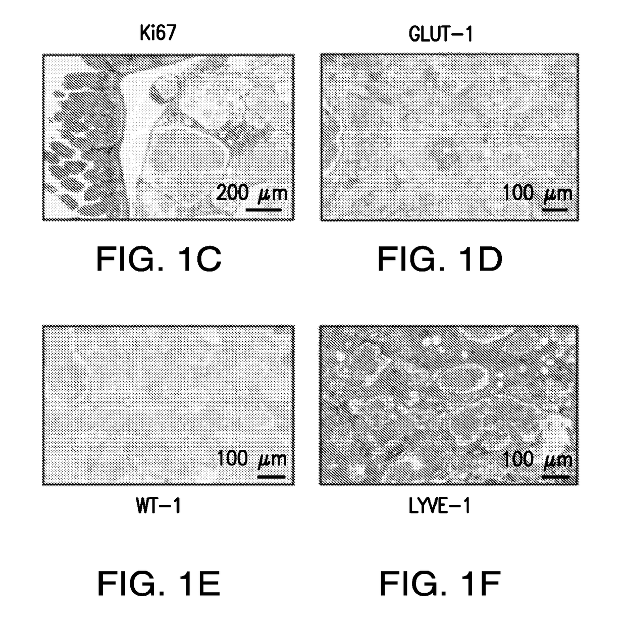 Use of phosphoinositide 3-kinase inhibitors for treatment of vascular malformations