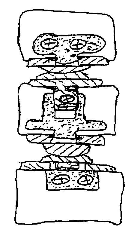 Artificial disc replacement (ADR) fixation methods and apparatus