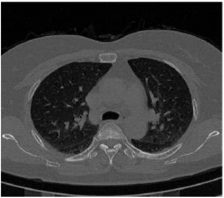 Medical image segmentation method based on correlation matrix self-learning and explicit rank constraint