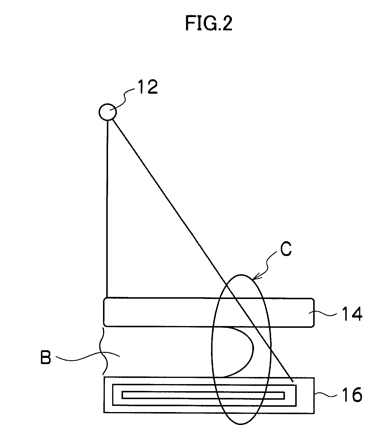 Image processing apparatus and image processing method, and recording medium for processing breast image based on local contrast values in a local region in a mammary gland region of breast image