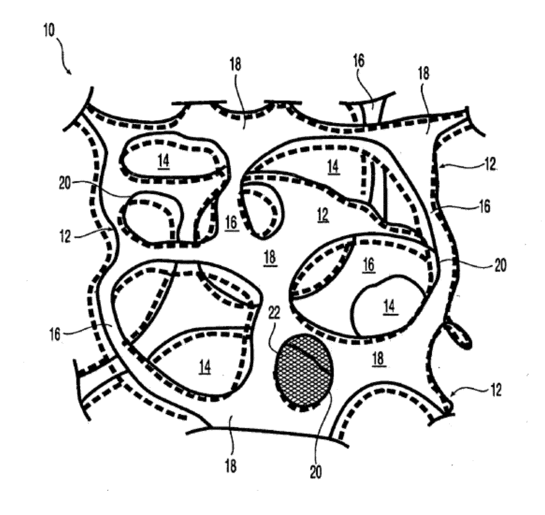 At least partially resorbable reticulated elastomeric matrix elements and methods of making same