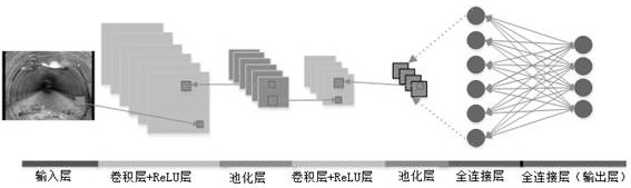 A Method for Removing Redundancy of Drainage Pipeline Defects