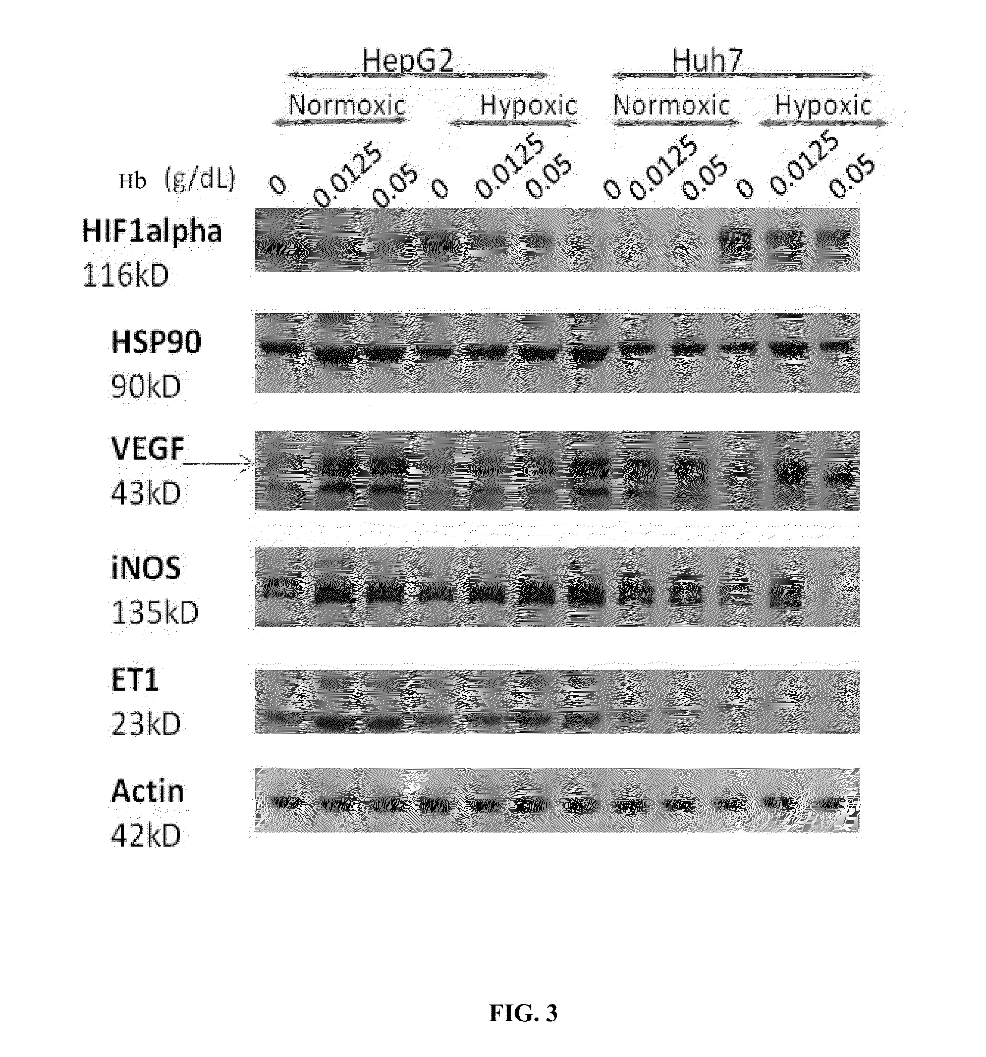 Hemoglobin-based oxygen carrier-containing pharmaceutical composition for cancer targeting treatment and prevention of cancer recurrence