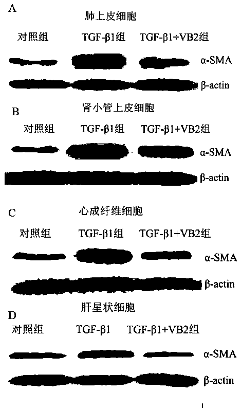 Purpose of vitamin B2 to preparation of medicines for preventing and treating fibrosis diseases