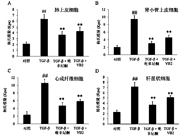 Purpose of vitamin B2 to preparation of medicines for preventing and treating fibrosis diseases