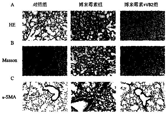 Purpose of vitamin B2 to preparation of medicines for preventing and treating fibrosis diseases