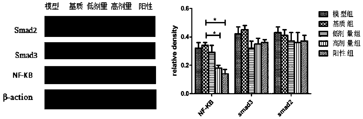 Traditional Chinese medicine compound hydrogel for skin wound treating and healing, and preparation method and application thereof