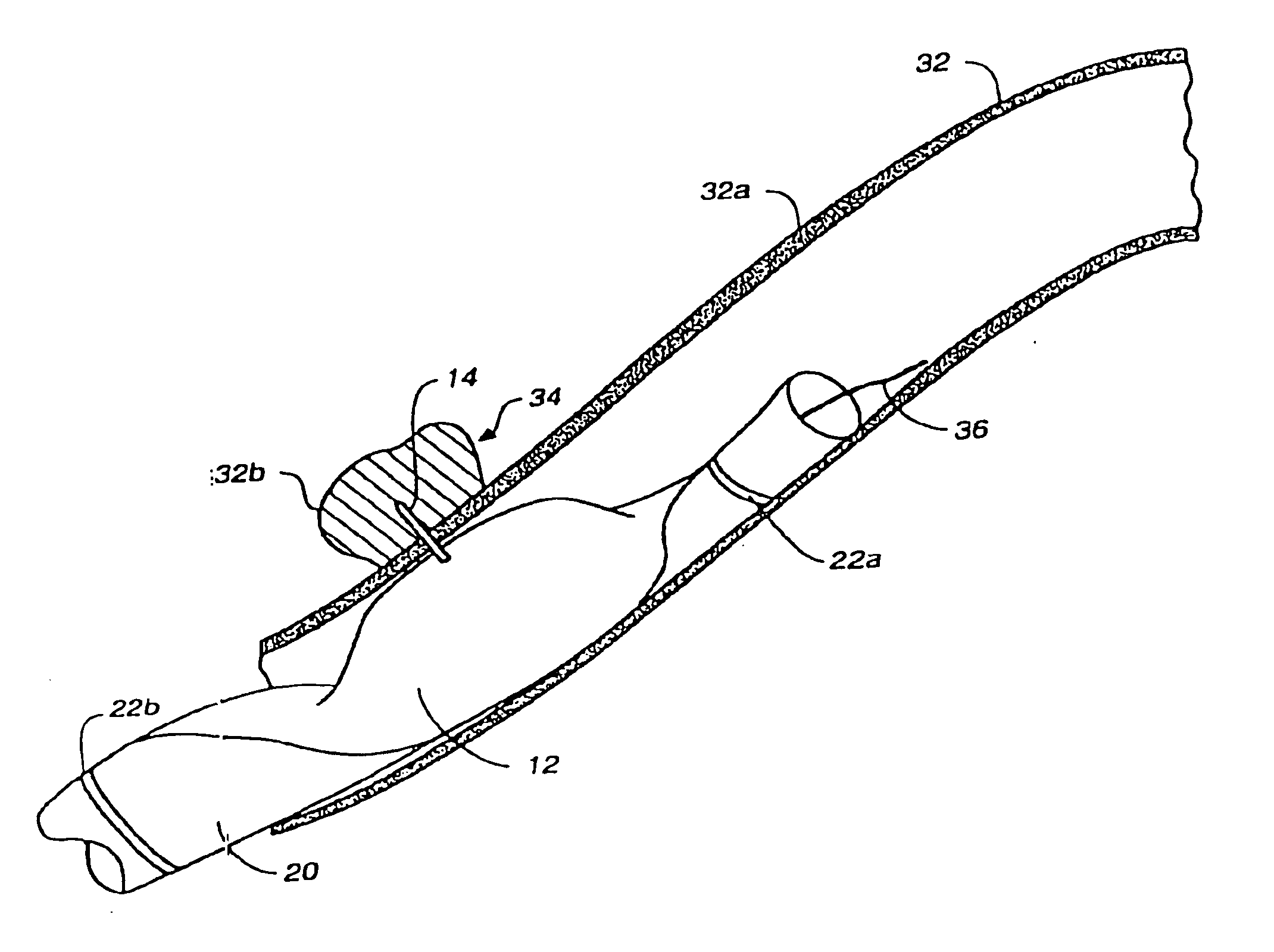 Methods and systems for inhibiting arrhythmia