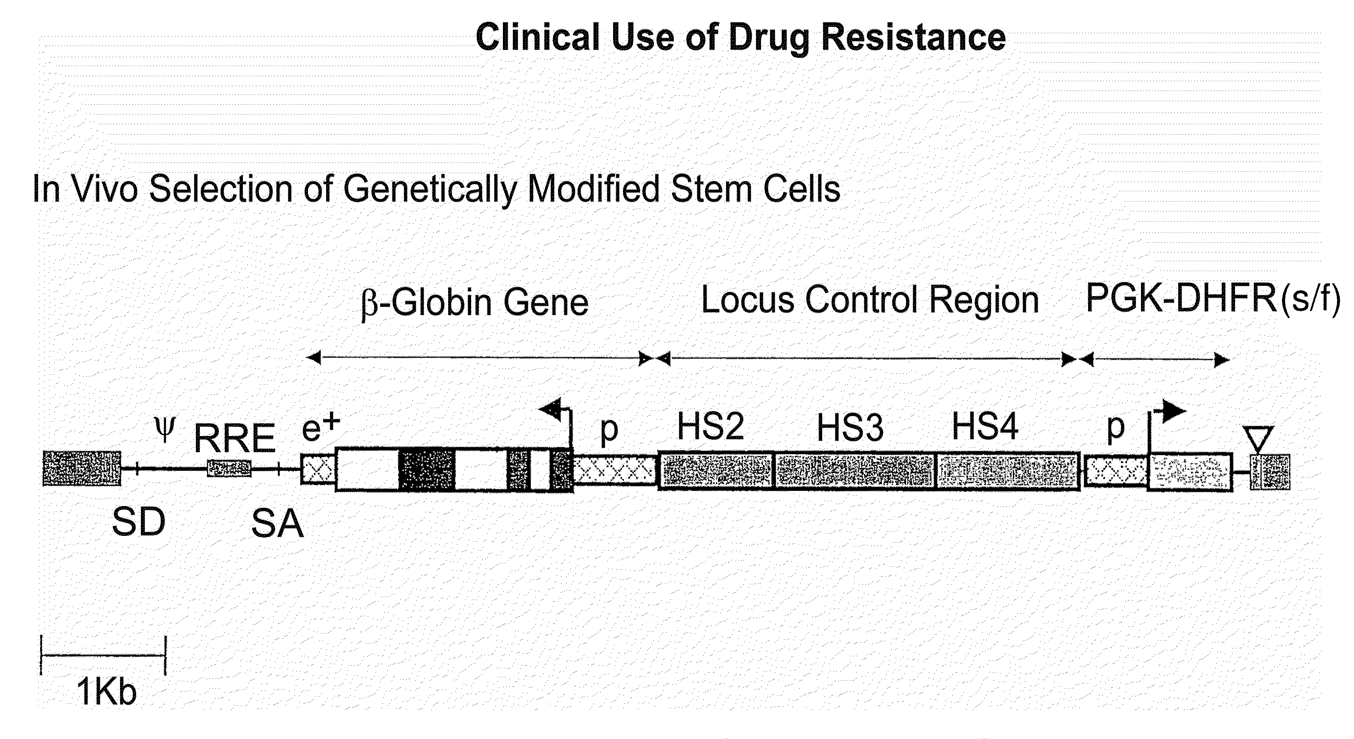 Vector encoding human globin gene and use thereof in treatment of hemoglobinopathies