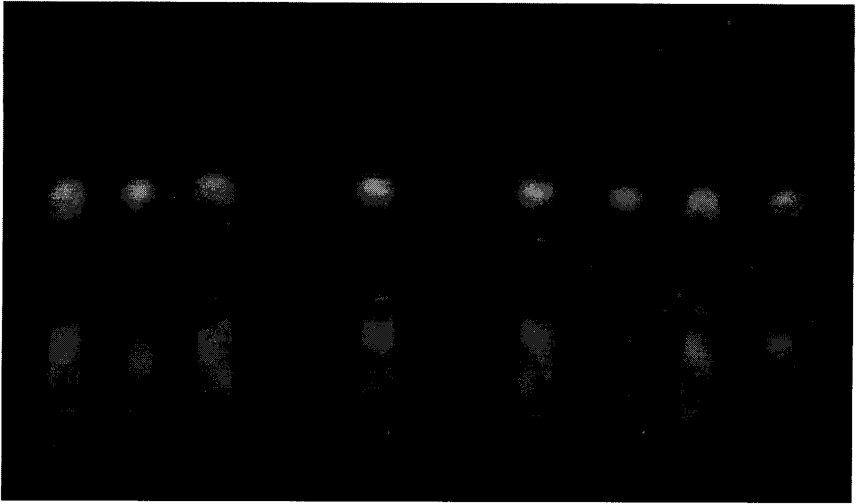 Method for preparing irrigating solution with anti-tumor function