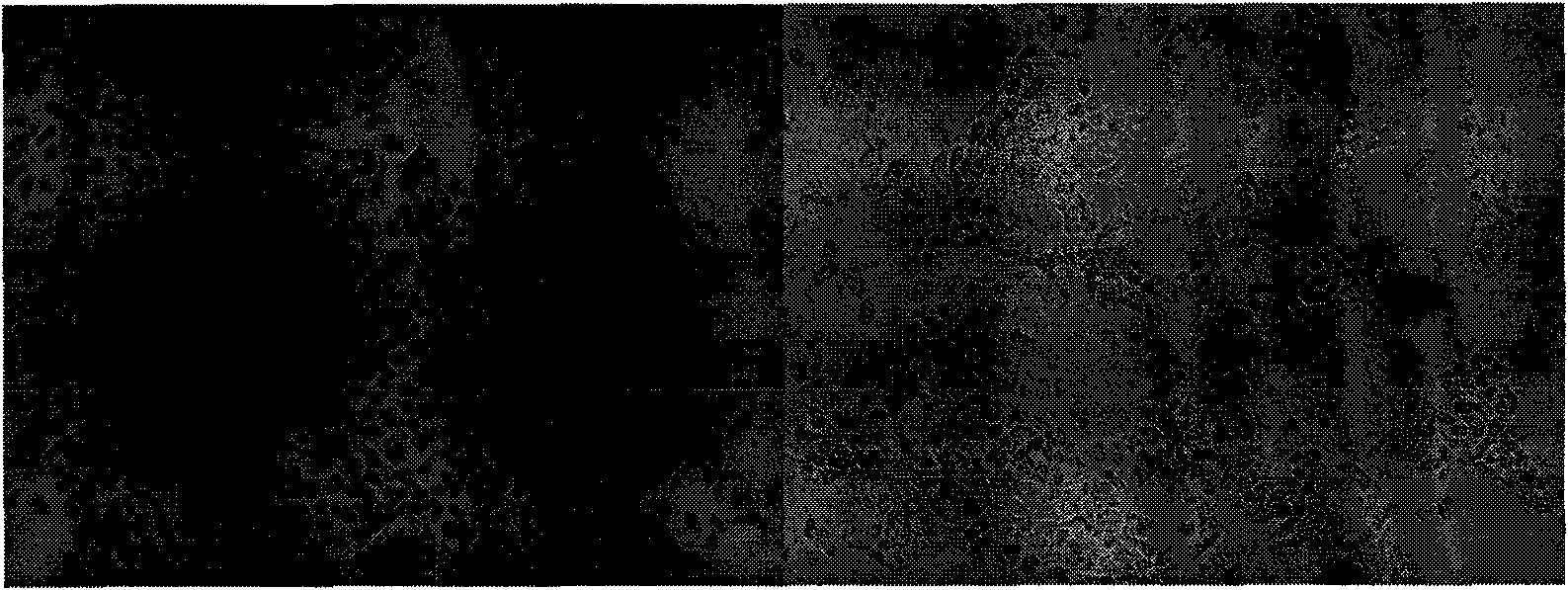 Method for preparing irrigating solution with anti-tumor function