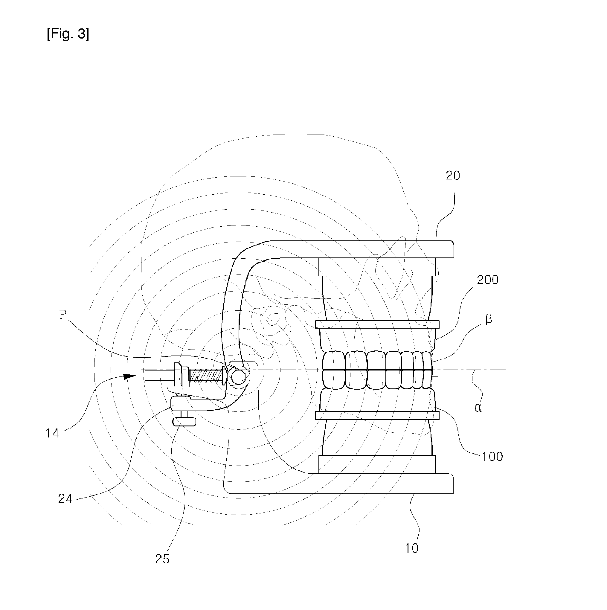 Articulator