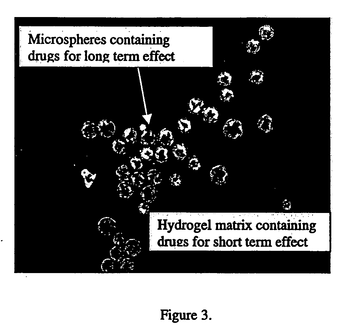 In situ controlled release drug delivery system