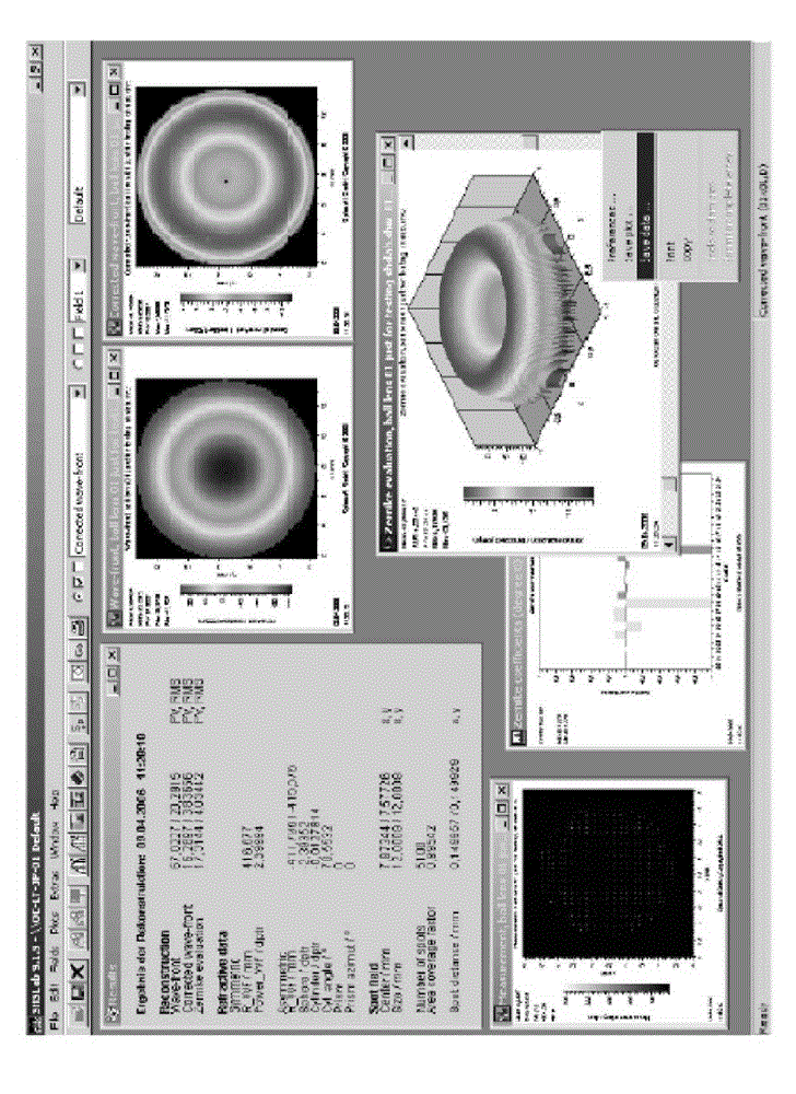 Systems and methods for the inspection of contact lenses