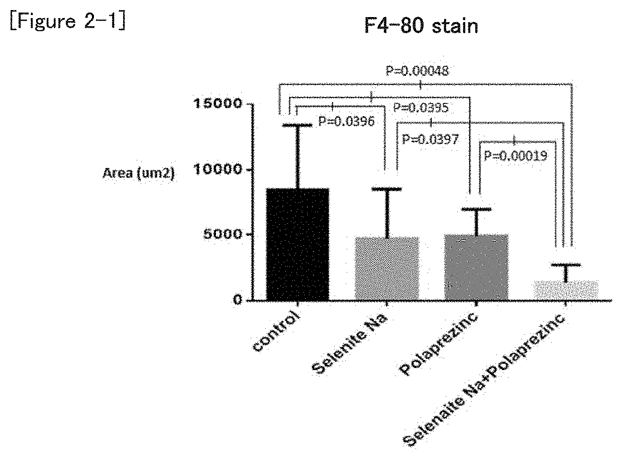 Method for treating non-alcoholic steatohepatitis (NASH) with the combination of polaprezinc and sodium selenite