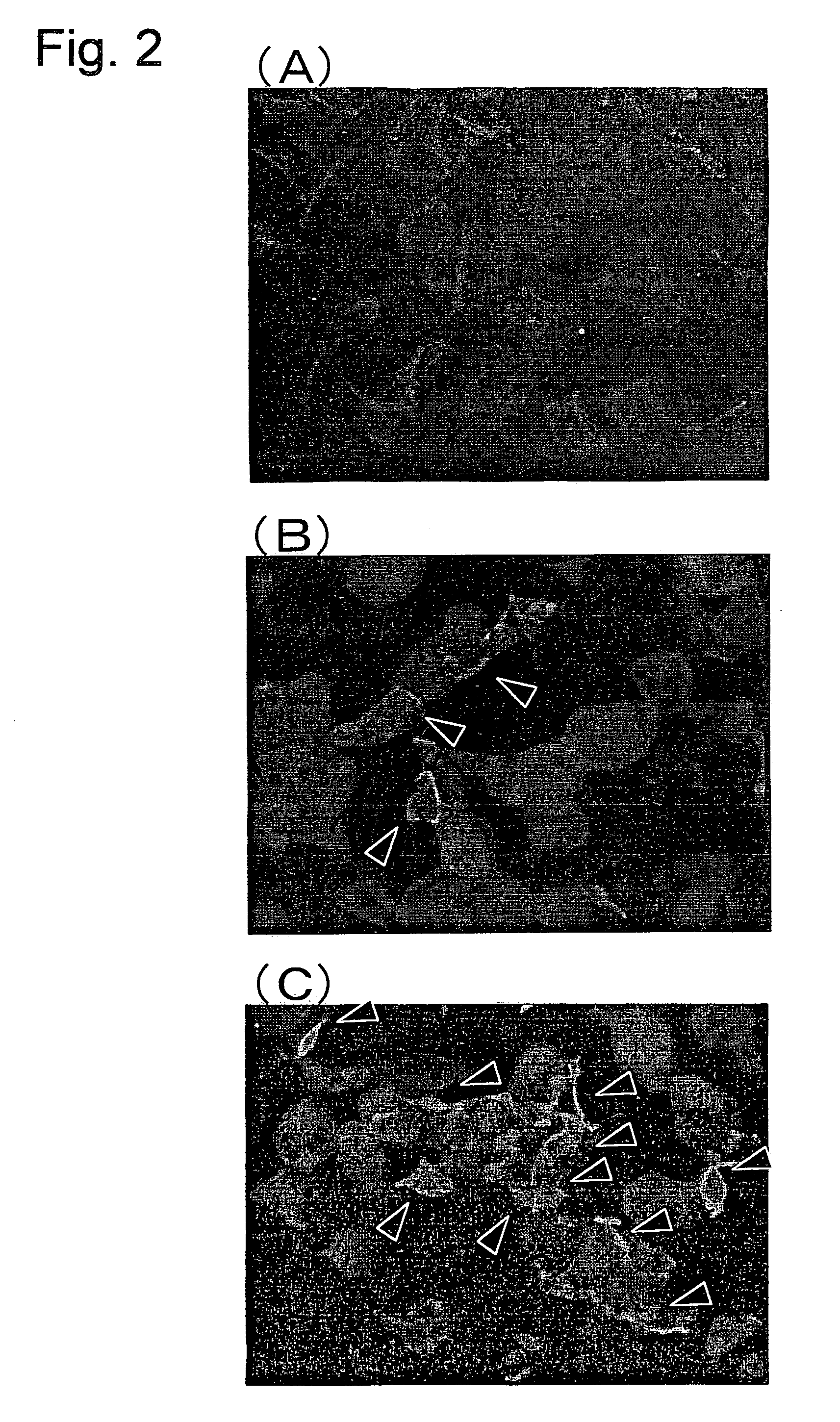 Method for evaluating the degree of maturity of corneocytes