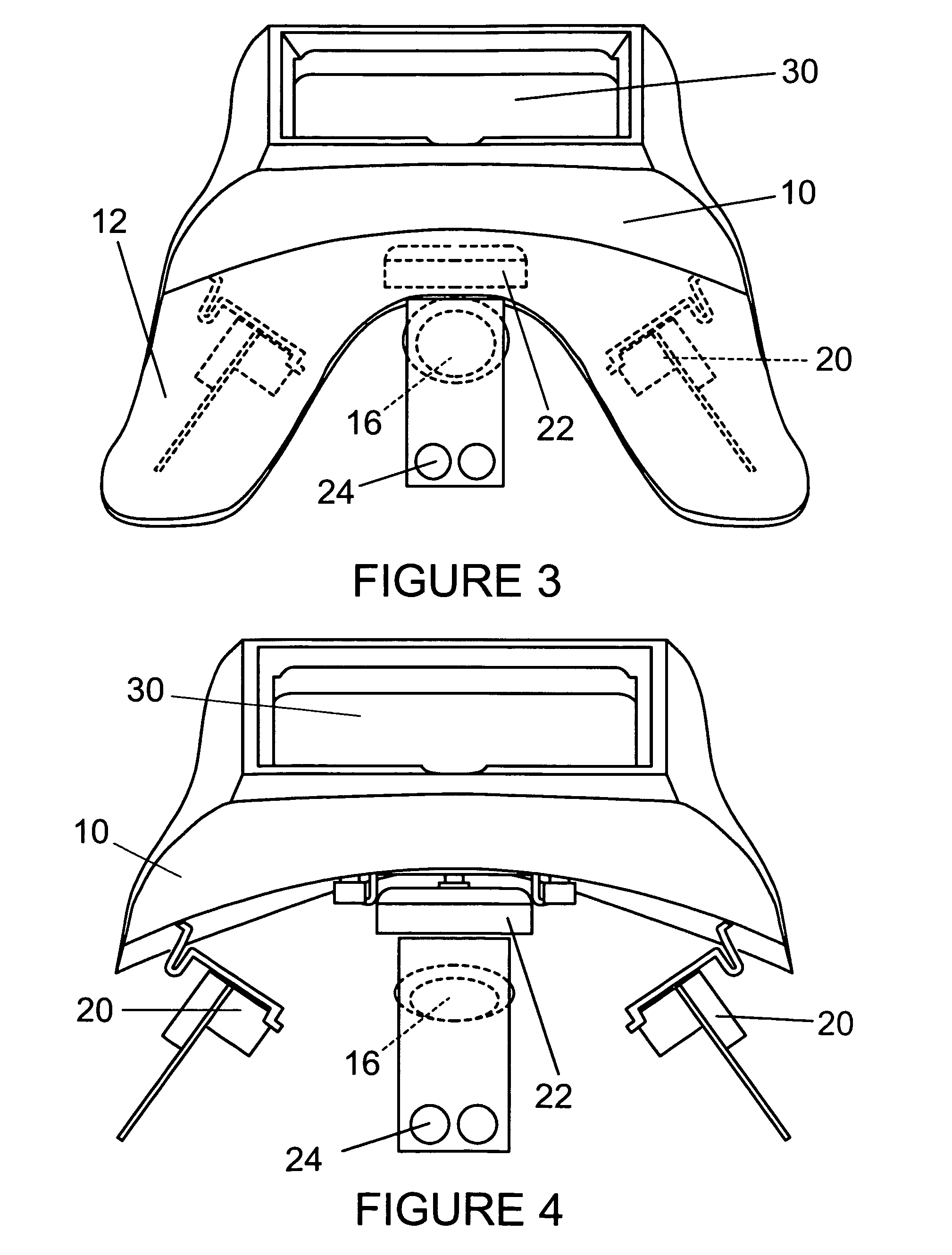 Orofacial radiation detection device for detection of radionuclide contamination from inhalation