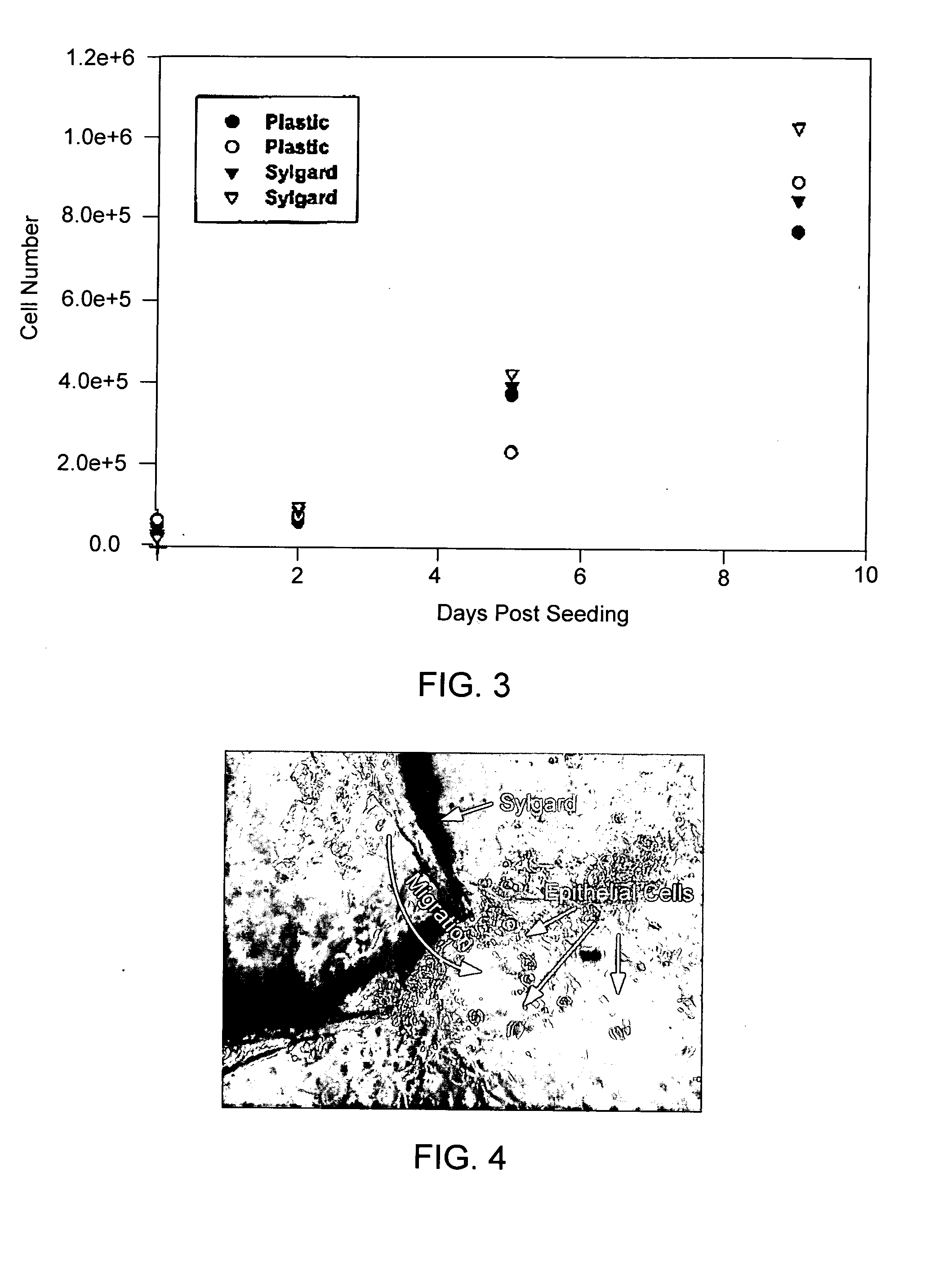 Use of contact lens for corneal cell transplant