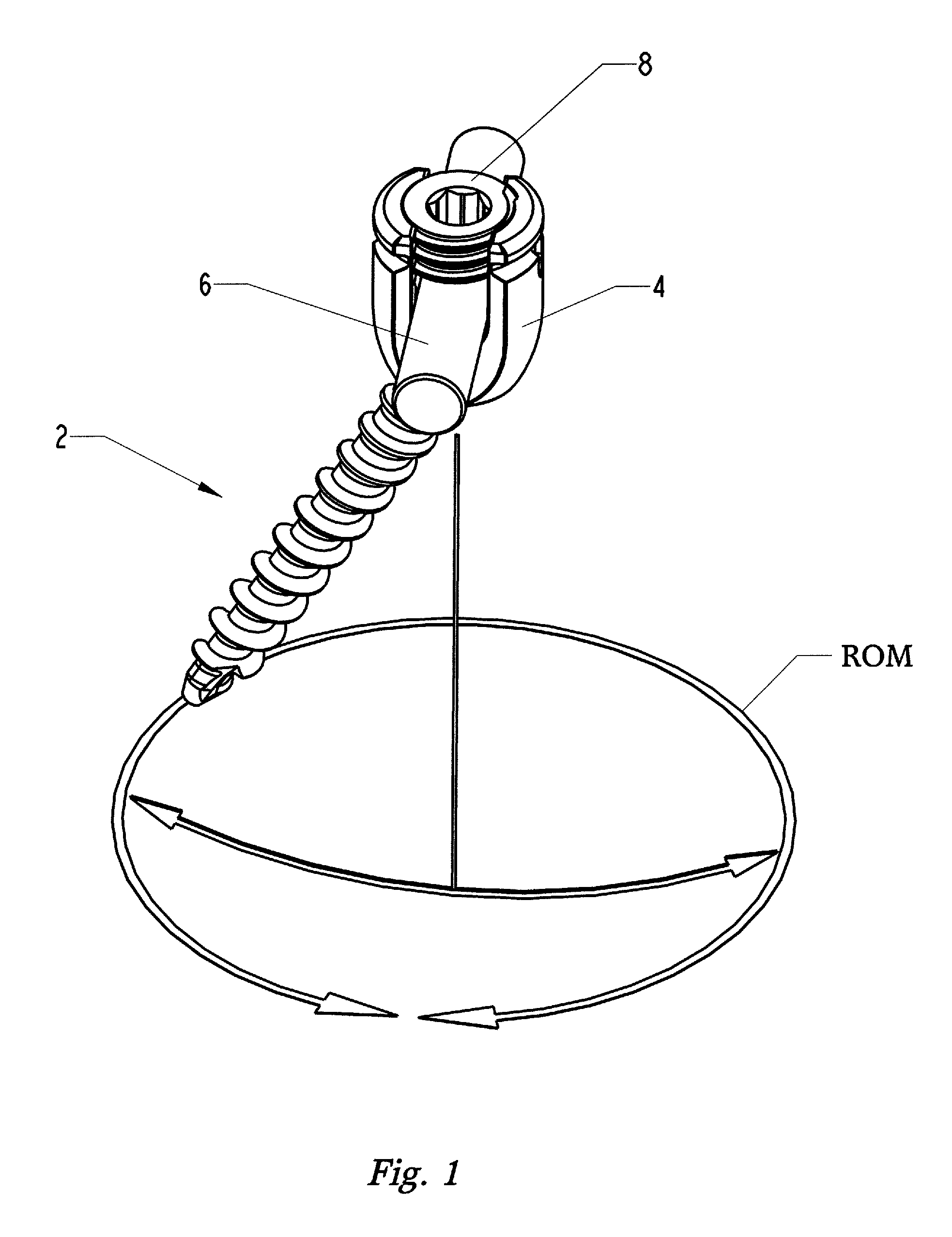 Top loading polyaxial ball and socket fastener with saddle