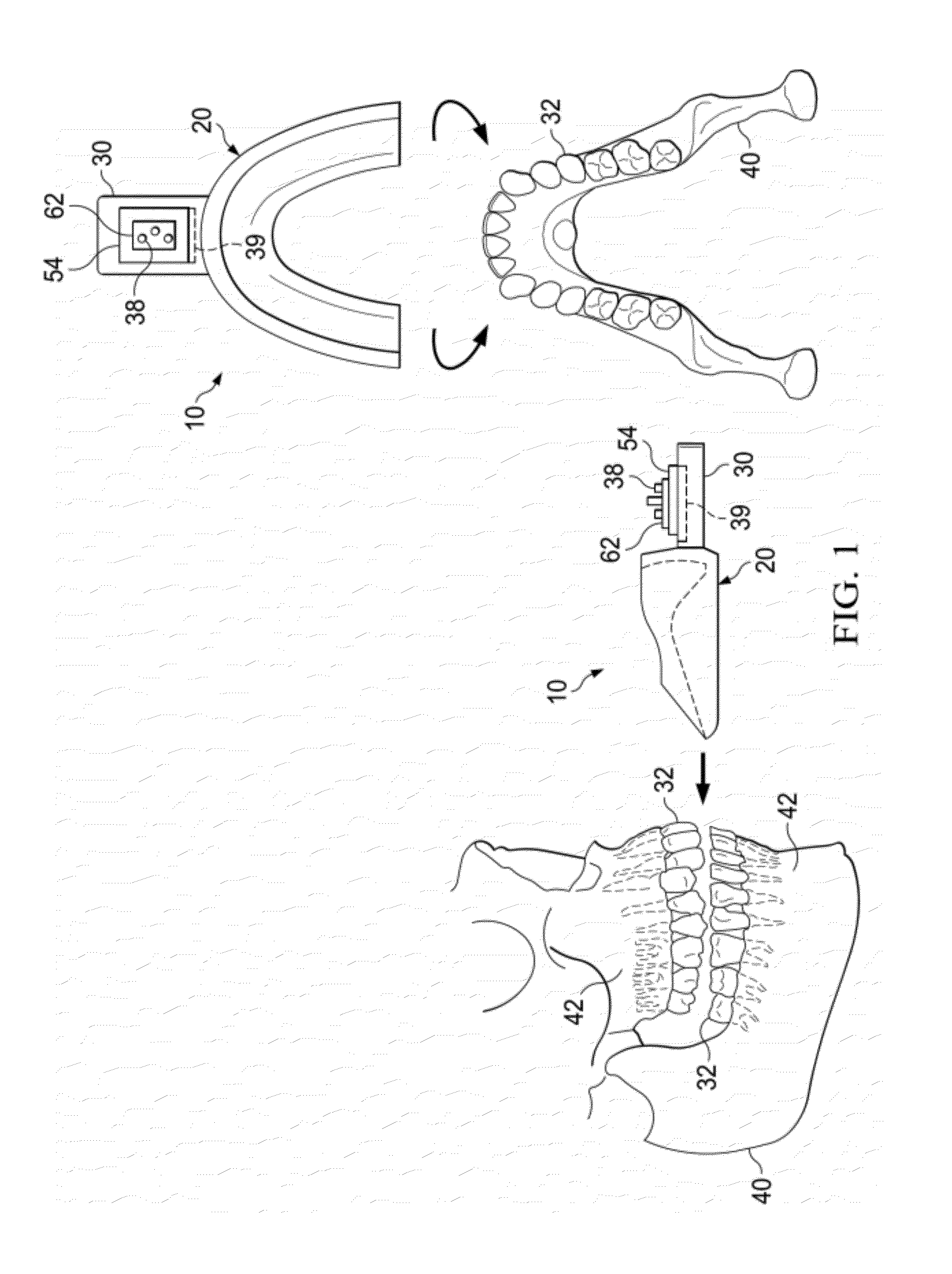 Vibrating orthodontic remodelling device