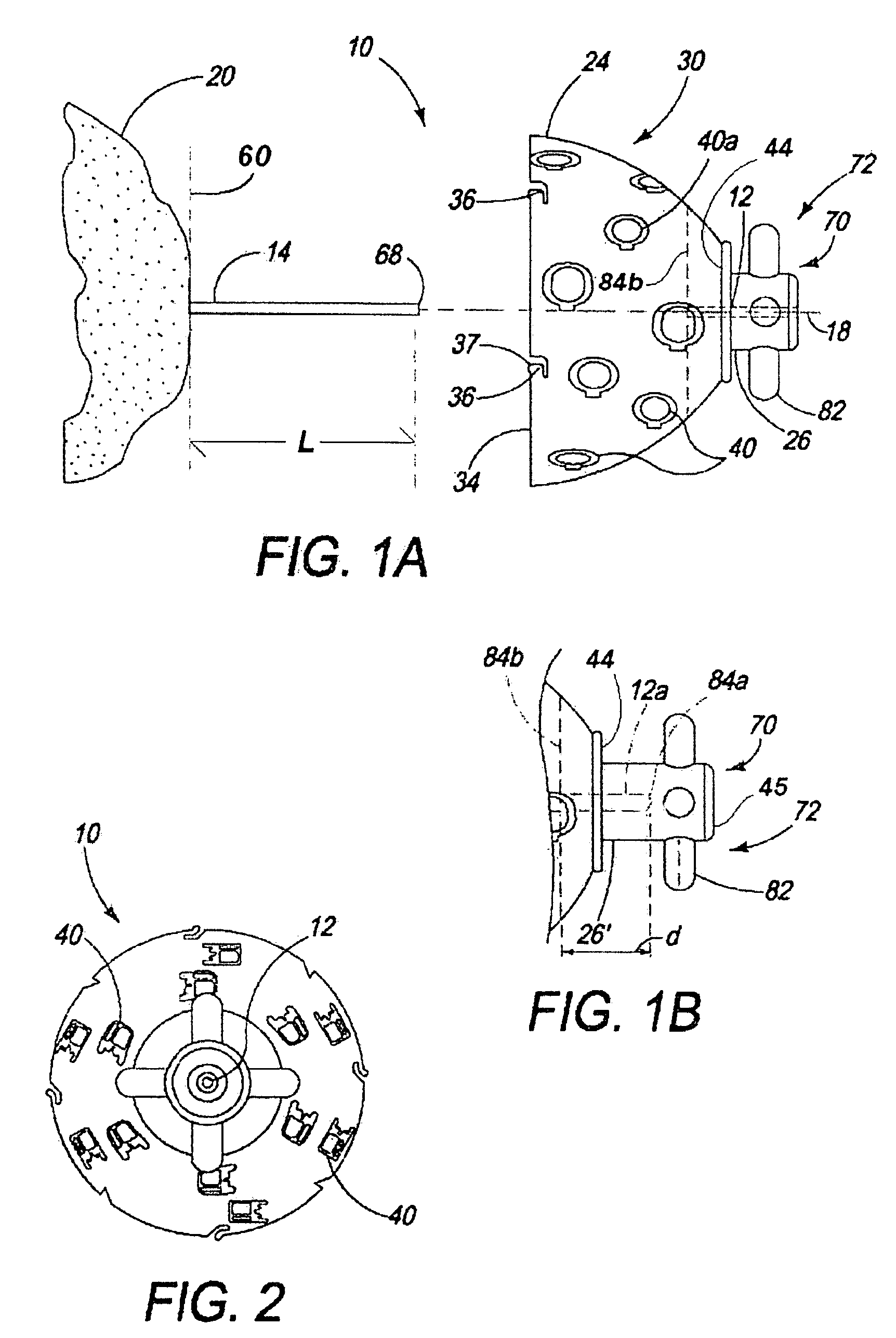 Resurfacing reamer with cutting struts