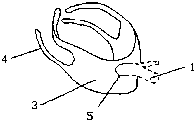 Laryngeal mask fixing band with good fixing effect