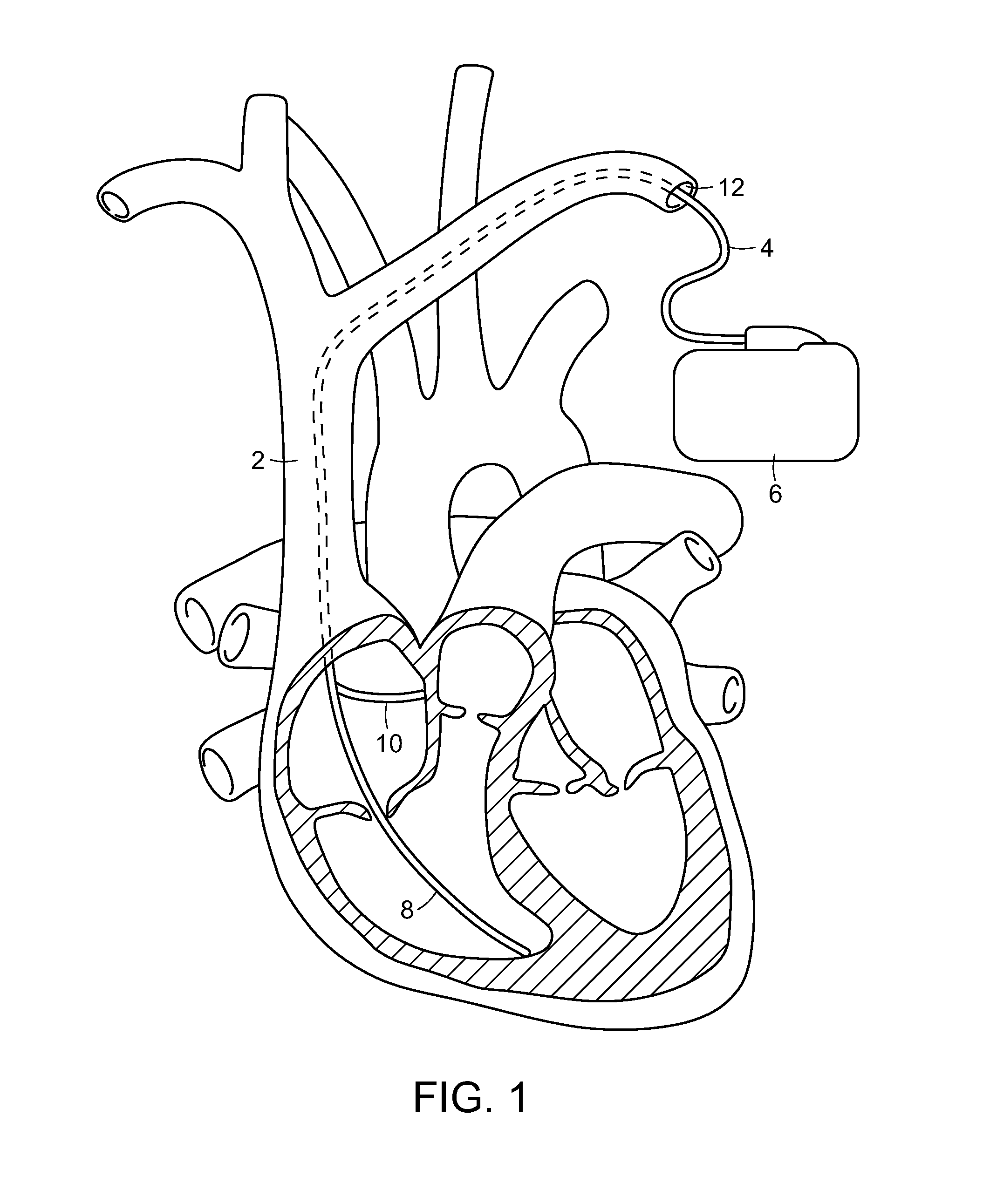 Cardiac pacemaker and uses thereof