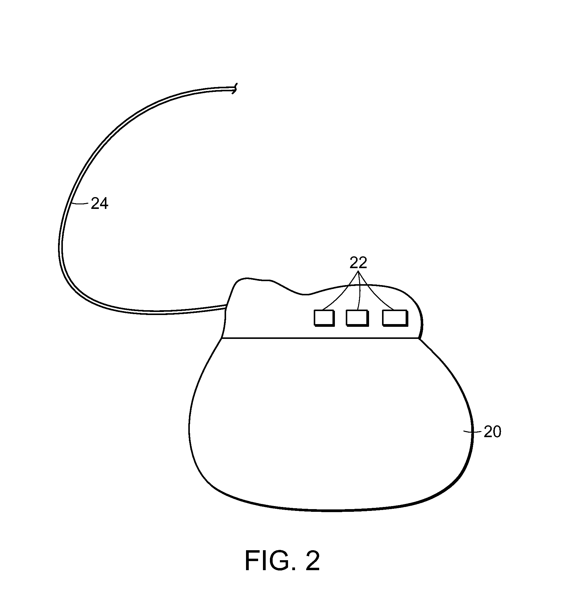 Cardiac pacemaker and uses thereof