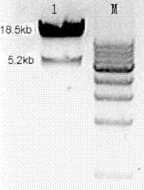 Method for constructing anti-mammitis transgenic mouse model and special vector for method