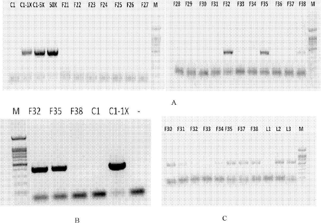 Method for constructing anti-mammitis transgenic mouse model and special vector for method