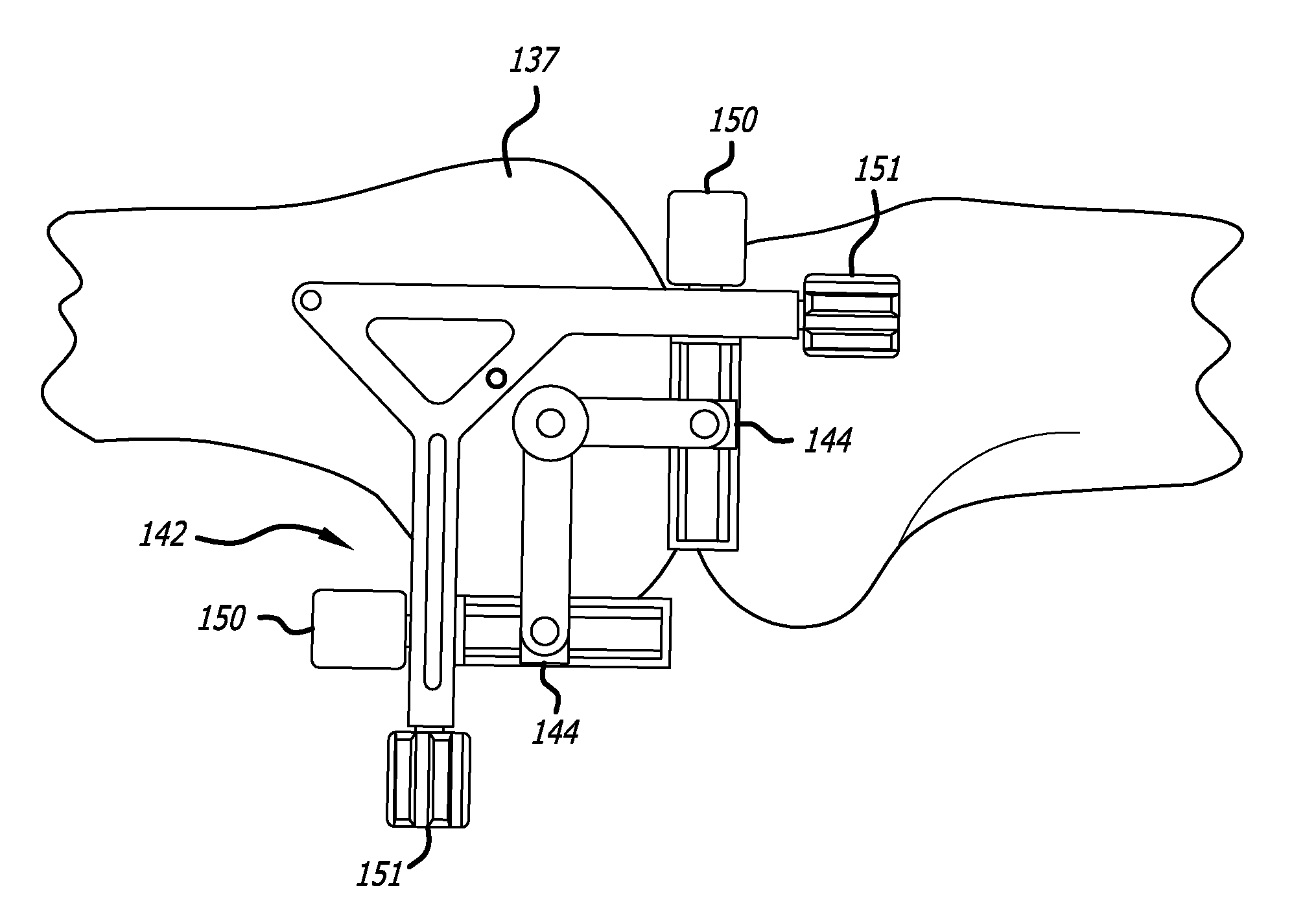 Surgical implantation method and devices for an extra-articular mechanical energy absorbing apparatus