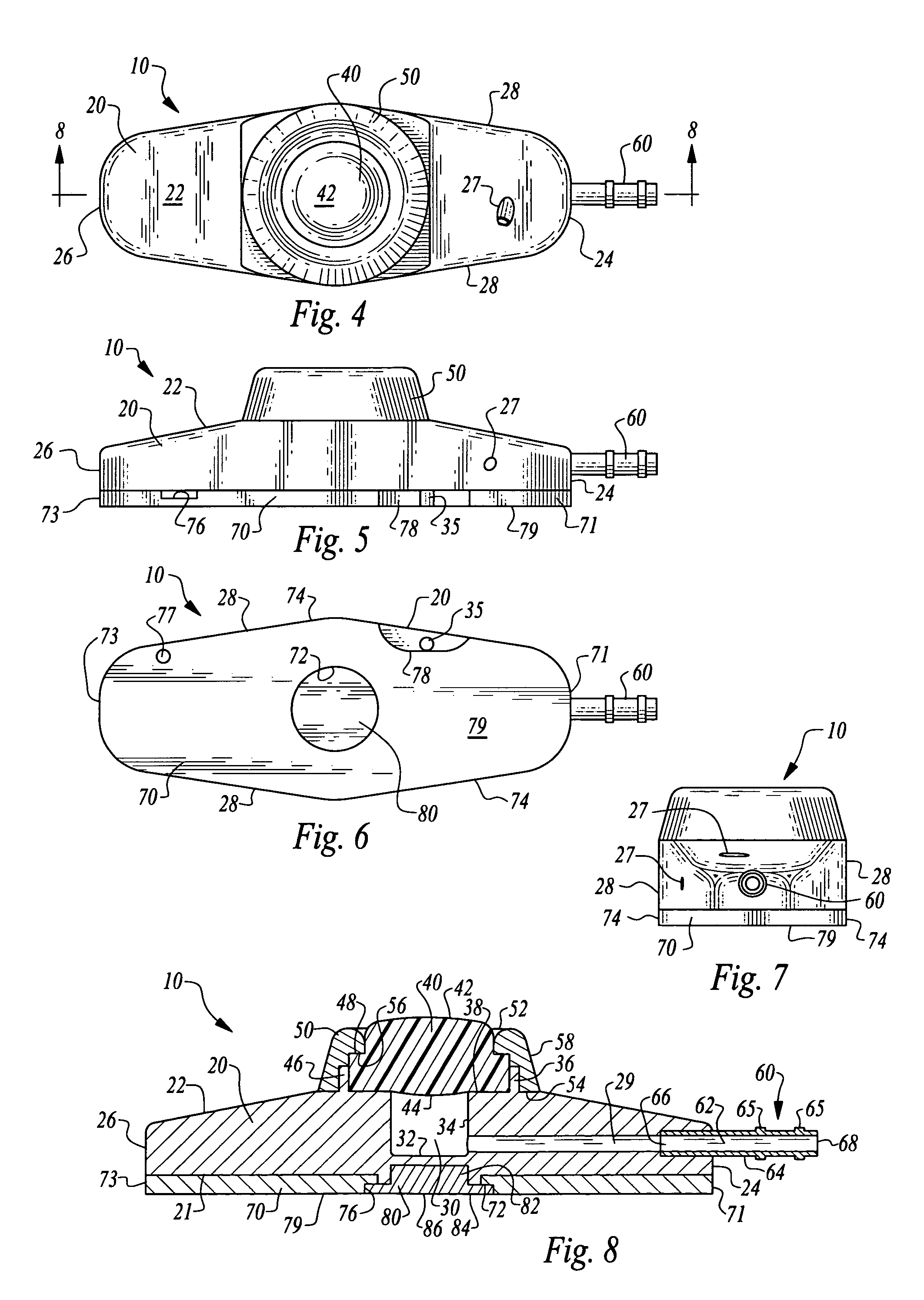 Stabilized implantable vascular access port