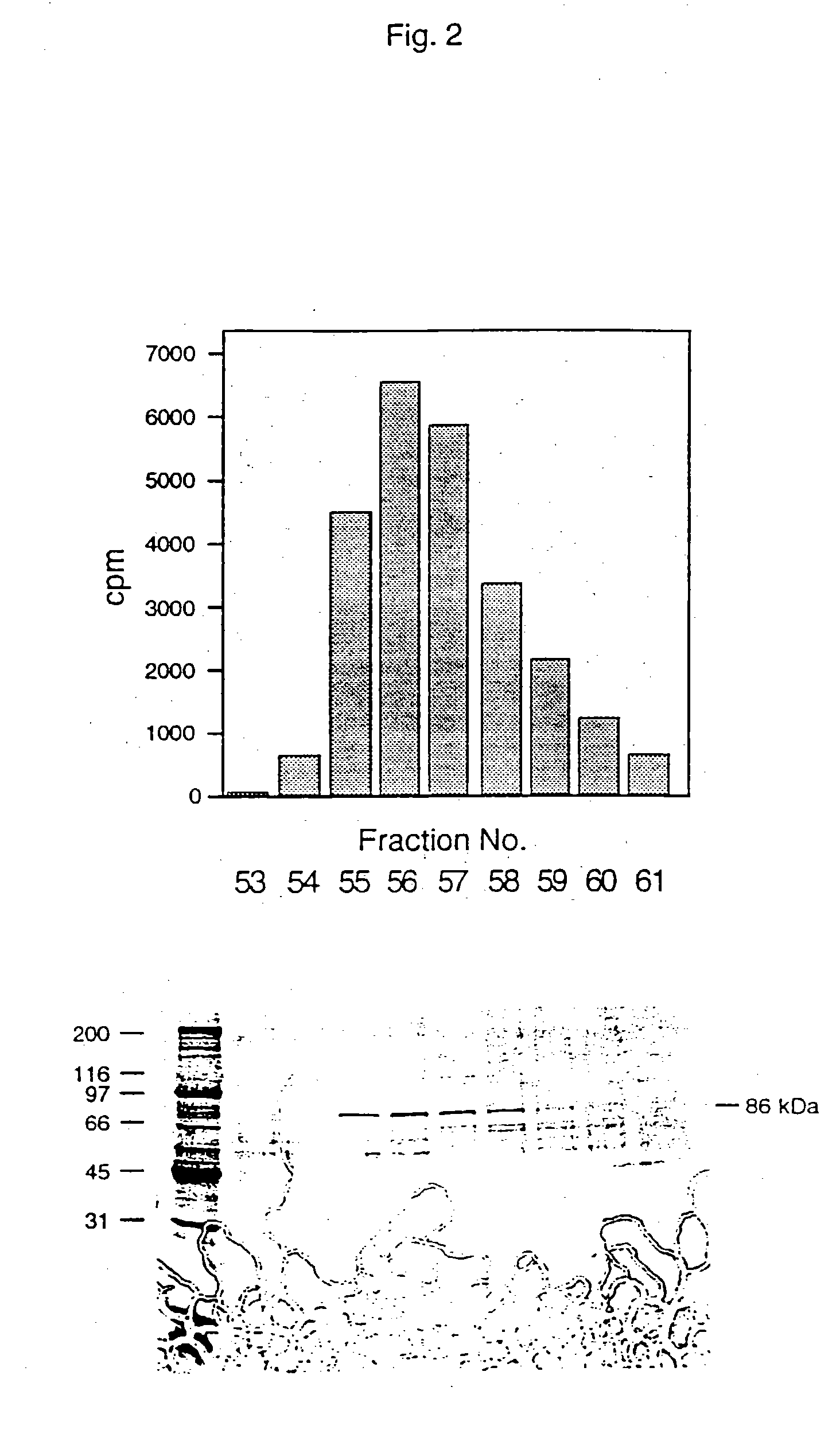 Antibodies to calcium independent cytosolic phospholipase A2/B enzymes