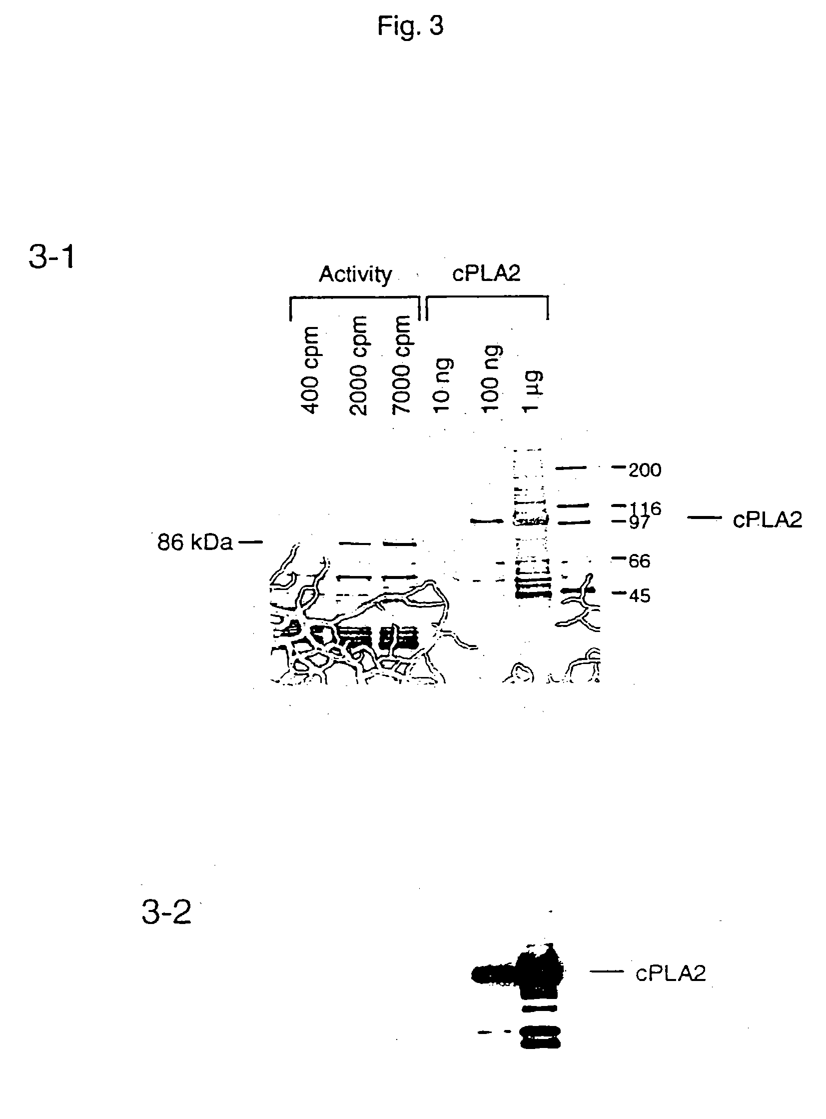 Antibodies to calcium independent cytosolic phospholipase A2/B enzymes