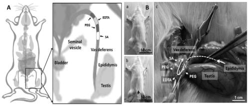 A new male contraceptive gel system