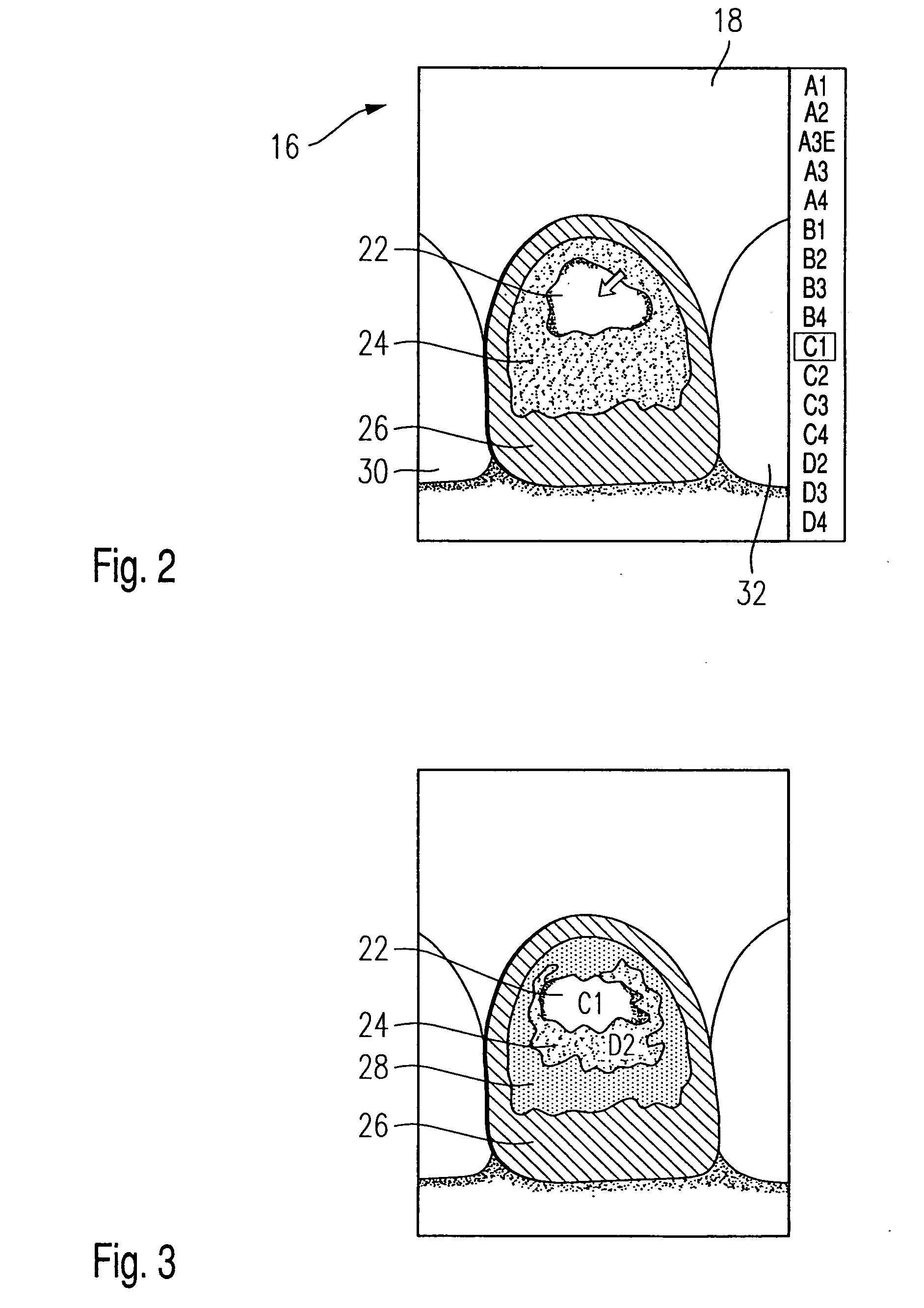 Method and apparatus for using a display associated with a dental kiln