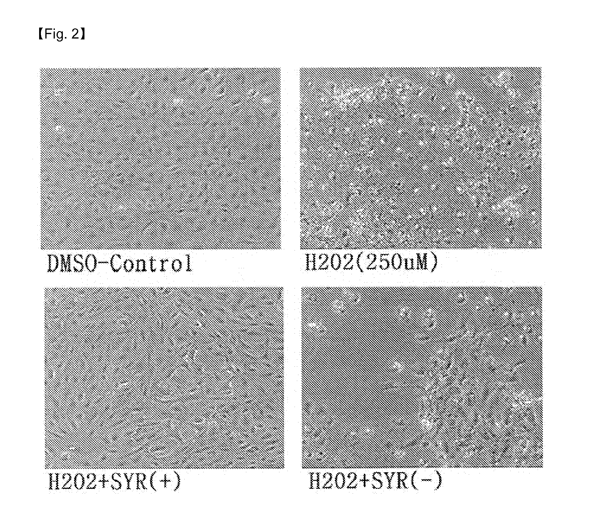 Composition for preventing or treating heart disease