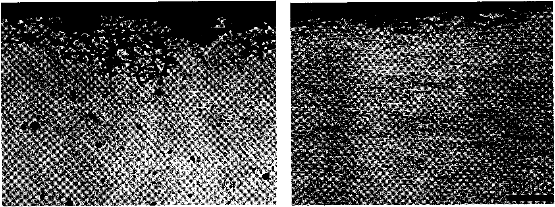 Thermal treatment method for aluminum alloy